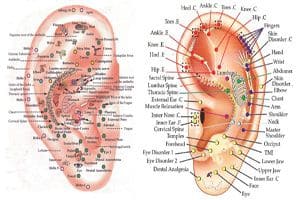 Auriculotherapy